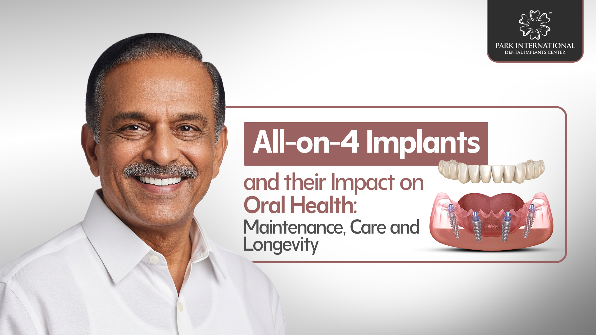 All-on-4 implants in Hyderabad
