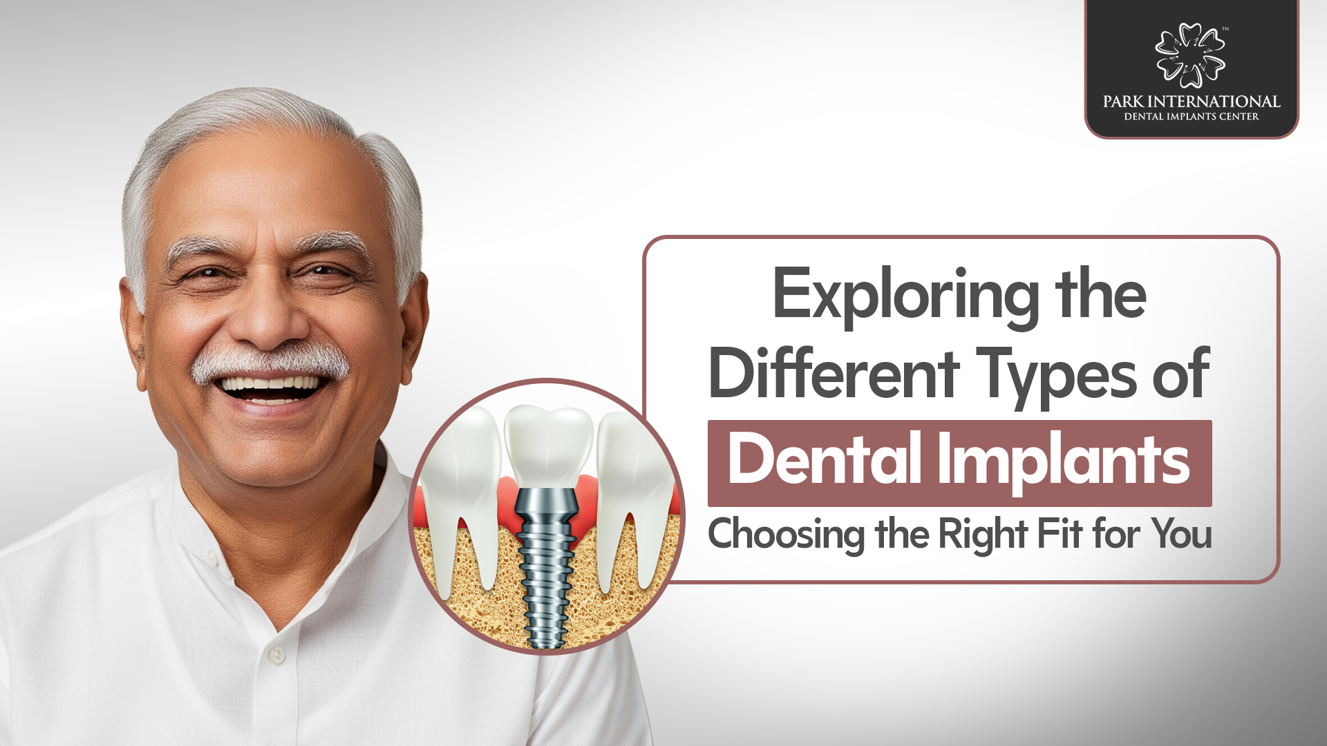 Dental Implants in Hyderabad