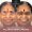 Full Mouth Dental Implants Near Banjara Hills