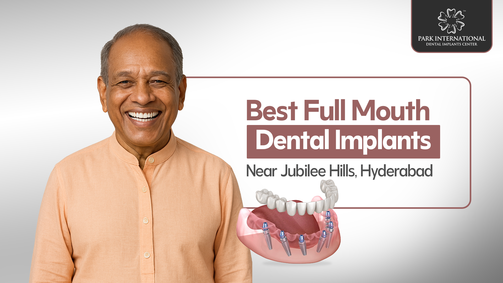 Best Full Mouth Dental Implants Near Jubilee Hills