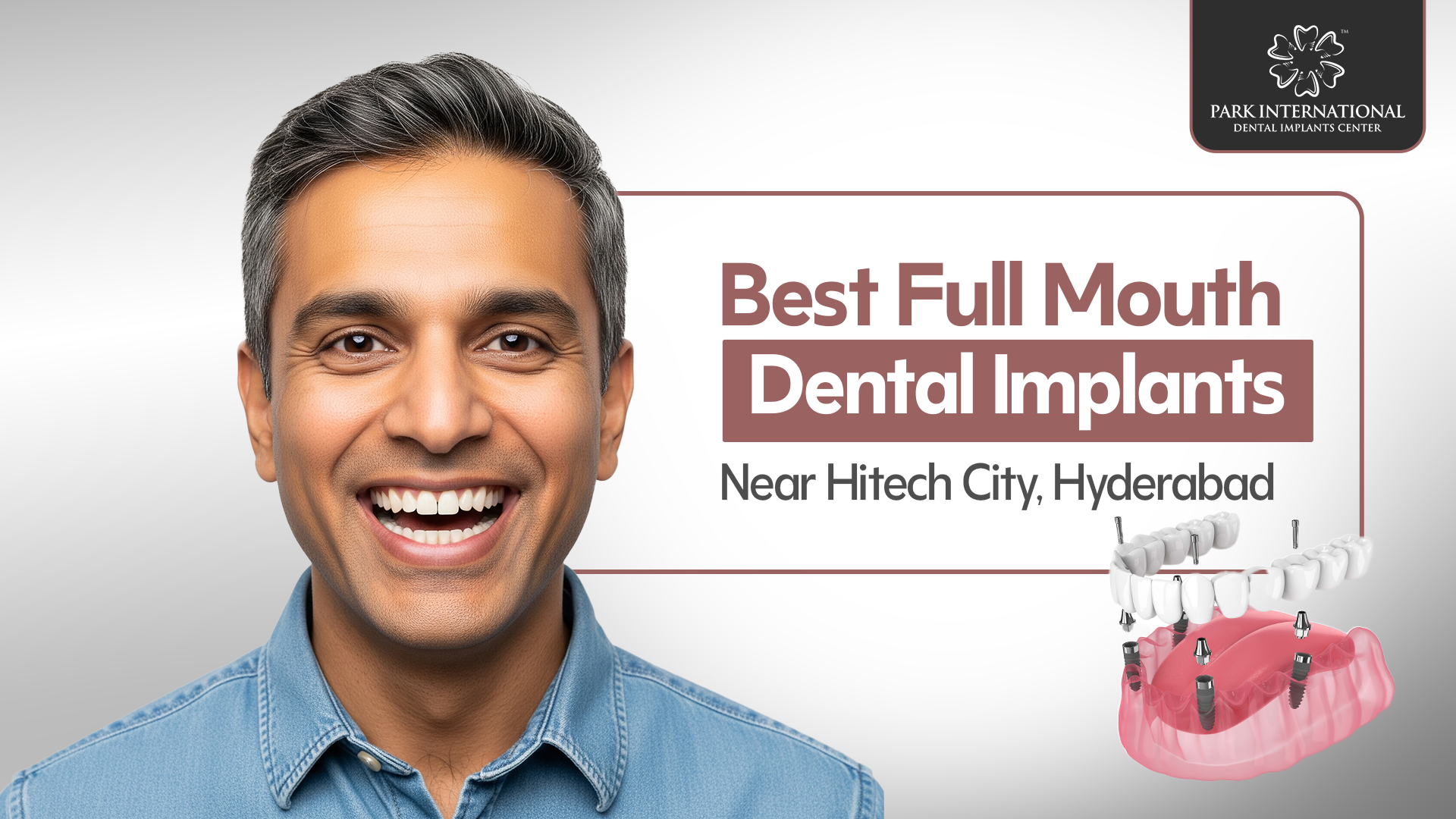 Best Full Mouth Dental Implants Near Hitech City