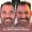 Full Mouth Dental Implants in Hyderabad