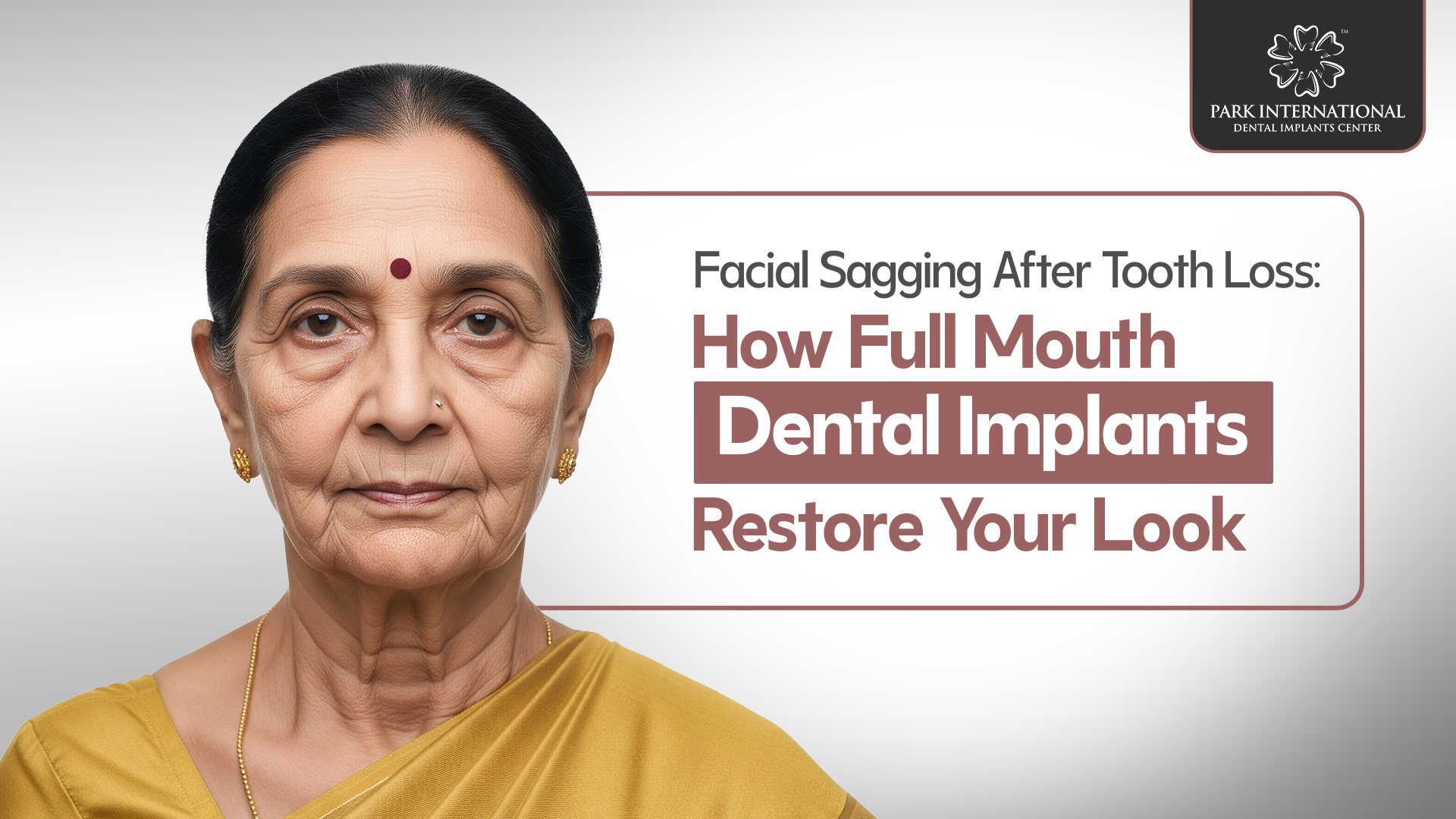 full mouth dental implants in Hyderabad